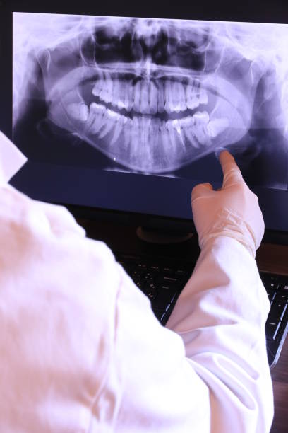 Best Emergency Dentist for Knocked-Out Tooth in Fowler, CA