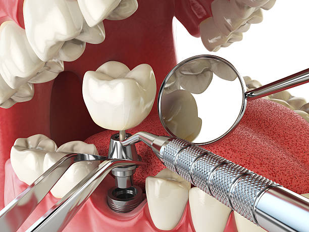 Best Emergency Dental Services for Seniors in Fowler, CA